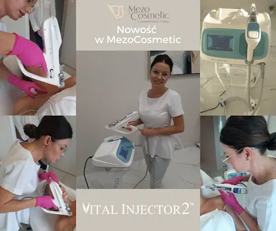 MezoCosmetic - Kosmetologia estetyczna i Trychologia Opole - endermologia - depilacja laserowa - mezoterapia mikroigłowa